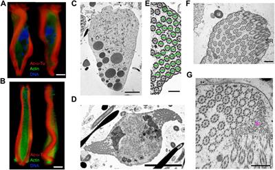 Axonemal Growth and Alignment During Paraspermatogenesis in the Marine Gastropod Strombus luhuanus